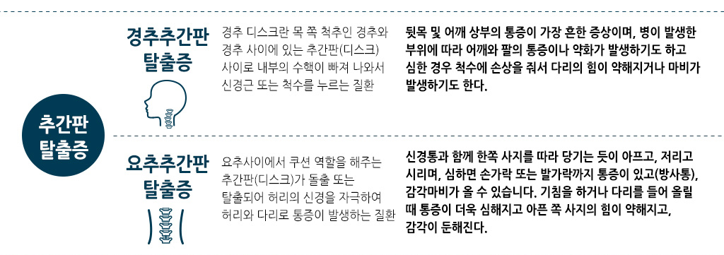 한국한의원, 한국한의원 근골격 클리닉, 치료범위, 추간판 탈출증