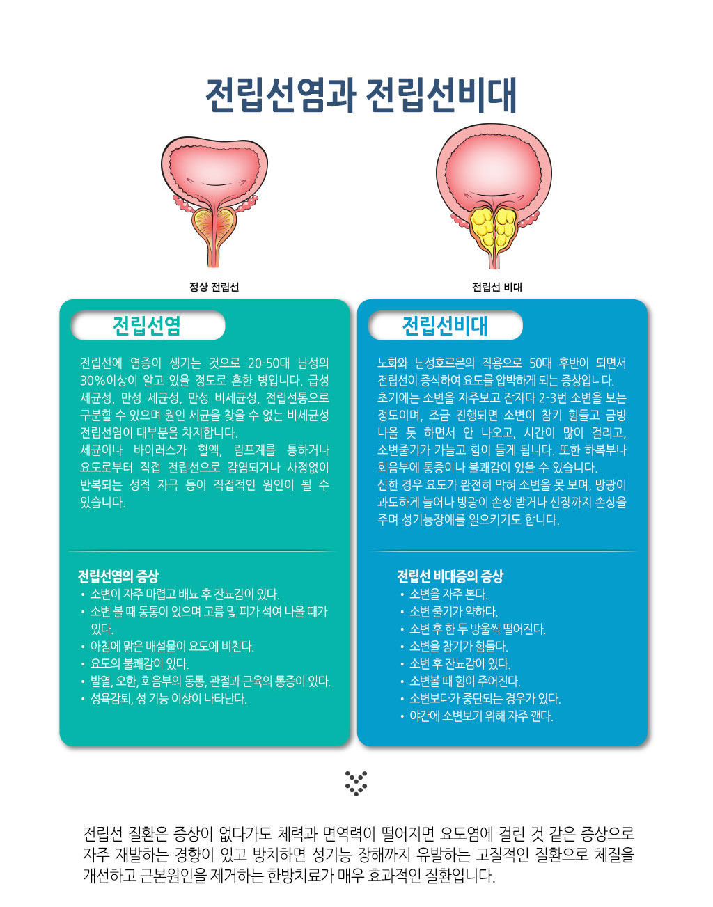 한국한의원, 한국한의원 전립선 클리닉, 전립선염 증상, 전립선비대 증상